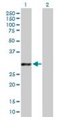 Anti-GCLM antibody produced in mouse purified immunoglobulin, buffered aqueous solution