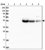 Anti-SLC2A10 antibody produced in rabbit Prestige Antibodies&#174; Powered by Atlas Antibodies, affinity isolated antibody, buffered aqueous glycerol solution