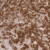 Anti-PRL antibody produced in rabbit Prestige Antibodies&#174; Powered by Atlas Antibodies, affinity isolated antibody