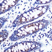 Anti-Monoamine Oxidase B (MAOB) antibody produced in rabbit