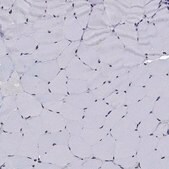 Anti-TYMS antibody produced in rabbit Prestige Antibodies&#174; Powered by Atlas Antibodies, affinity isolated antibody, buffered aqueous glycerol solution