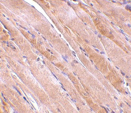 Anti-Emerin antibody produced in rabbit affinity isolated antibody