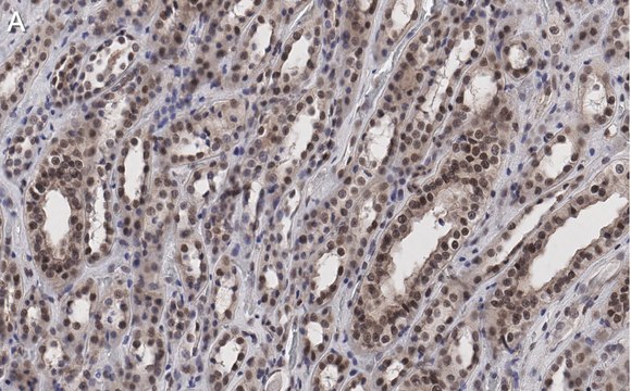 Anti-MLL/HRX CT Antibody, clone 5C15 ZooMAb&#174; Rabbit Monoclonal recombinant, expressed in HEK 293 cells