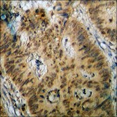 Anti-phospho-Estrogen Receptor-? (pSer87) antibody produced in rabbit affinity isolated antibody