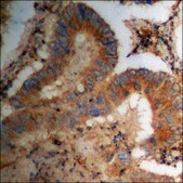 Anti-phospho-PKA CAT (pThr197) antibody produced in rabbit affinity isolated antibody