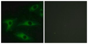 Anti-Collagen I &#945;2 antibody produced in rabbit affinity isolated antibody