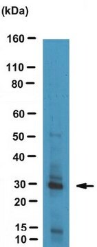 Anti-Red Fluorescent Protein Antibody, clone 1DS-1A6 | MAB10765 ascites fluid, clone 1DS-1A6, from mouse