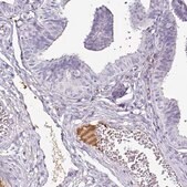 Monoclonal Anti-TTR antibody produced in mouse Prestige Antibodies&#174; Powered by Atlas Antibodies, clone CL0290, purified immunoglobulin, buffered aqueous glycerol solution