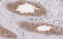 Anti-Pyk2/PTK2B Antibody, clone 3B7 ZooMAb&#174; Rabbit Monoclonal recombinant, expressed in HEK 293 cells