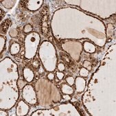 Anti-GCLM antibody produced in rabbit affinity isolated antibody, buffered aqueous glycerol solution