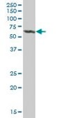 Anti-ALDH4A1 antibody produced in mouse purified immunoglobulin, buffered aqueous solution