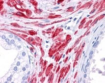 Anti-STAT5B (ab2) antibody produced in rabbit affinity isolated antibody