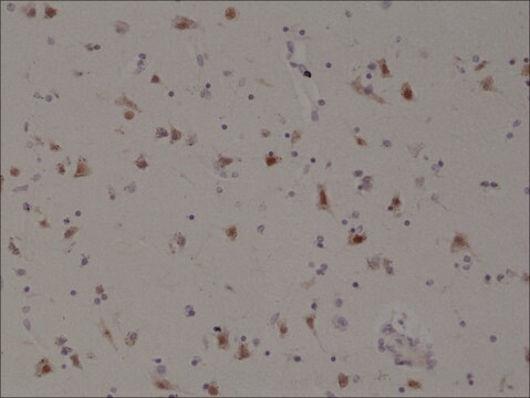 Anti-SATB2 antibody, Rabbit monoclonal recombinant, expressed in HEK 293 cells, clone RM365, purified immunoglobulin