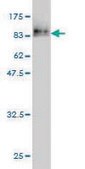 Monoclonal Anti-KRT17 antibody produced in mouse clone 2D10, purified immunoglobulin, buffered aqueous solution