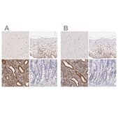 Anti-ESR1 antibody produced in rabbit Prestige Antibodies&#174; Powered by Atlas Antibodies, affinity isolated antibody, buffered aqueous glycerol solution