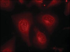 Anti-phospho-HDAC8 (pSer39) antibody produced in rabbit affinity isolated antibody