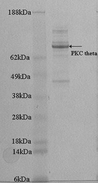 PKC &#952; Protein, active, 10 &#181;g Active, recombinant full-length human PKC theta with a C-terminal 6His-tag. For use in Kinase Assays.