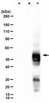 Anti-phospho IGPR-1 (Ser220)