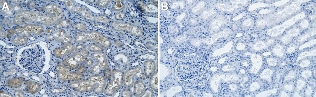 Anti-TRIM8 Antibody, clone 1I18 ZooMAb&#174; Rabbit Monoclonal recombinant, expressed in HEK 293 cells