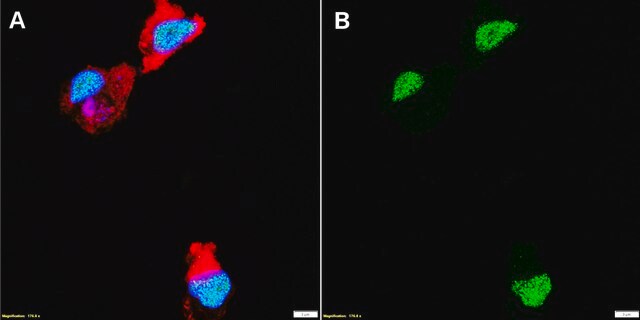 Anti-PU.1/Spi1 Antibody, clone 1B8 ZooMAb&#174; Rabbit Monoclonal recombinant, expressed in HEK 293 cells