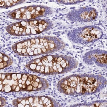 Anti-UGT2B4 antibody produced in rabbit Prestige Antibodies&#174; Powered by Atlas Antibodies, affinity isolated antibody, buffered aqueous glycerol solution