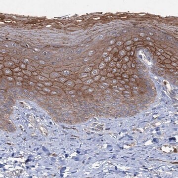 Anti-PTPN3 antibody produced in rabbit Prestige Antibodies&#174; Powered by Atlas Antibodies, affinity isolated antibody, buffered aqueous glycerol solution