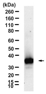 Anti-VAChT Antibody, clone 1J10 ZooMAb&#174; Rabbit Monoclonal recombinant, expressed in HEK 293 cells