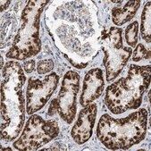 Anti-OGDH antibody produced in rabbit Prestige Antibodies&#174; Powered by Atlas Antibodies, affinity isolated antibody, buffered aqueous glycerol solution