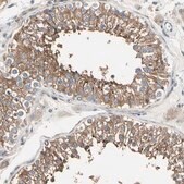Anti-PRKAR2B antibody produced in rabbit Prestige Antibodies&#174; Powered by Atlas Antibodies, affinity isolated antibody, buffered aqueous glycerol solution