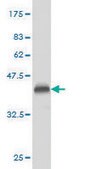 Monoclonal Anti-PLD2 antibody produced in mouse clone 1C5, purified immunoglobulin, buffered aqueous solution