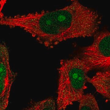 Anti-NOP14 antibody produced in rabbit Prestige Antibodies&#174; Powered by Atlas Antibodies, affinity isolated antibody