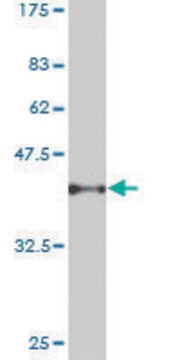 ANTI-PSPH antibody produced in mouse clone 3C1, purified immunoglobulin, buffered aqueous solution