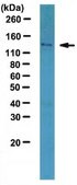 Anti-HDAC4 Antibody serum, from rabbit