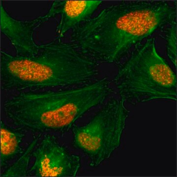 Anti-Histone H2AX antibody, Rabbit monoclonal recombinant, expressed in HEK 293 cells, clone RM214, purified immunoglobulin