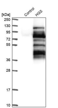 Anti-HGS antibody produced in rabbit Prestige Antibodies&#174; Powered by Atlas Antibodies, affinity isolated antibody, buffered aqueous glycerol solution