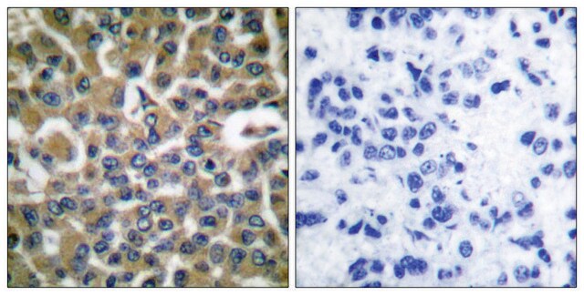 Anti-EEF2 antibody produced in rabbit affinity isolated antibody