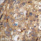 Anti-phospho-NF-kappaB p65 (pSer468) antibody produced in rabbit affinity isolated antibody