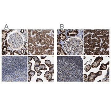 Anti-HIBADH antibody produced in rabbit Prestige Antibodies&#174; Powered by Atlas Antibodies, affinity isolated antibody, buffered aqueous glycerol solution, Ab1