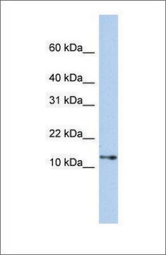 Anti-GNGT2 antibody produced in rabbit affinity isolated antibody