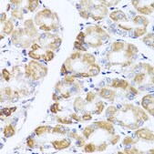 Anti-PIK3CA antibody produced in rabbit