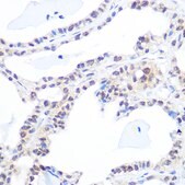 Anti-DNA topoisomerase I (TOP1) Antibody, clone 3D4W6, Rabbit Monoclonal