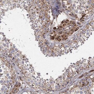 Anti-Slc38A7 Antibody Produced In Rabbit Prestige Antibodies&#174; Powered by Atlas Antibodies, affinity isolated antibody, buffered aqueous glycerol solution