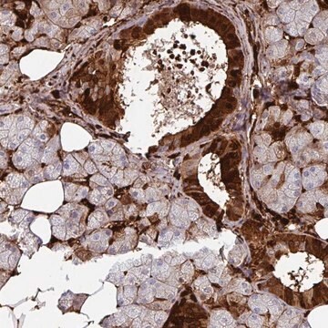 Anti-SLC5A10 antibody produced in rabbit Prestige Antibodies&#174; Powered by Atlas Antibodies, affinity isolated antibody, buffered aqueous glycerol solution