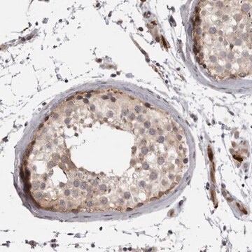 Anti-EPHA10 antibody produced in rabbit Prestige Antibodies&#174; Powered by Atlas Antibodies, affinity isolated antibody, buffered aqueous glycerol solution