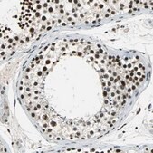 Anti-RBM14 antibody produced in rabbit Prestige Antibodies&#174; Powered by Atlas Antibodies, affinity isolated antibody, buffered aqueous glycerol solution
