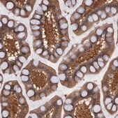Anti-SYK antibody produced in rabbit Prestige Antibodies&#174; Powered by Atlas Antibodies, affinity isolated antibody, buffered aqueous glycerol solution