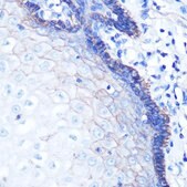 Anti-Na+/K+-ATPase antibody produced in rabbit