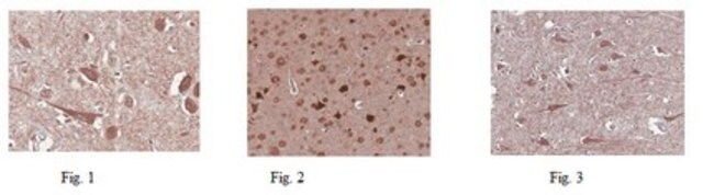 Anti-GluR2 Antibody from rabbit, purified by affinity chromatography