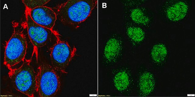 Anti-SETD5 Antibody, clone 3B22 ZooMAb&#174; Rabbit Monoclonal recombinant, expressed in HEK 293 cells