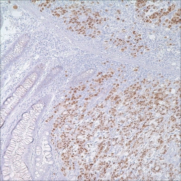 p53 (DO7) Mouse Monoclonal Antibody